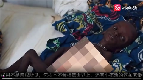乌干达儿童最真实<em>的</em>生活状态