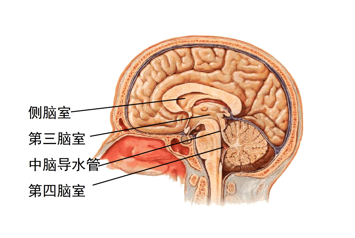 侧脑室