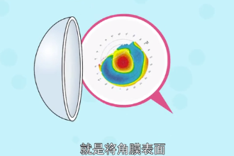 什么是角膜<em>地形图</em>